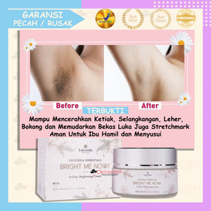 Info Ever White Smooth Axillary Cream Krim Whitening Pemutih Ketek Lipatan Katalog.or.id Info Ever White Smooth Axillary Cream Krim Whitening Pemutih Ketek Lipatan Katalog.or.id