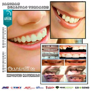 Info Biaya Tambal Gigi Katalog.or.id Info Biaya Tambal Gigi Katalog.or.id