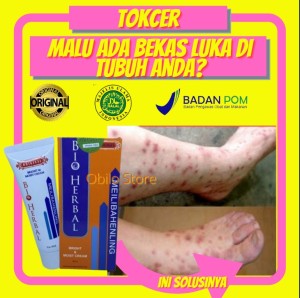 Harga Dermovate Ointment Warna Coklat Penghilang Bekas Luka Asli Arab Saudi Katalog.or.id Harga Dermovate Ointment Warna Coklat Penghilang Bekas Luka Asli Arab Saudi Katalog.or.id