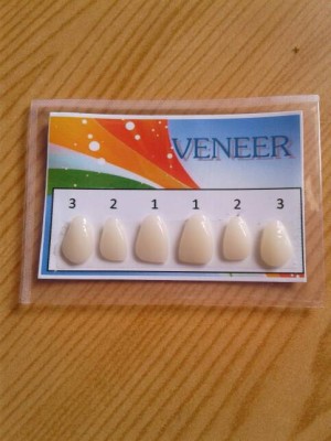 Katalog Biaya Veneer Gigi Katalog.or.id Katalog Biaya Veneer Gigi Katalog.or.id
