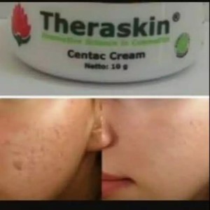 Info Theraskin Centac Cream Krim Scar Katalog.or.id Info Theraskin Centac Cream Krim Scar Katalog.or.id