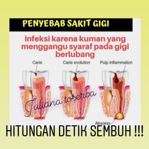 Katalog Biaya Tambal Gigi Depan Katalog.or.id Katalog Biaya Tambal Gigi Depan Katalog.or.id
